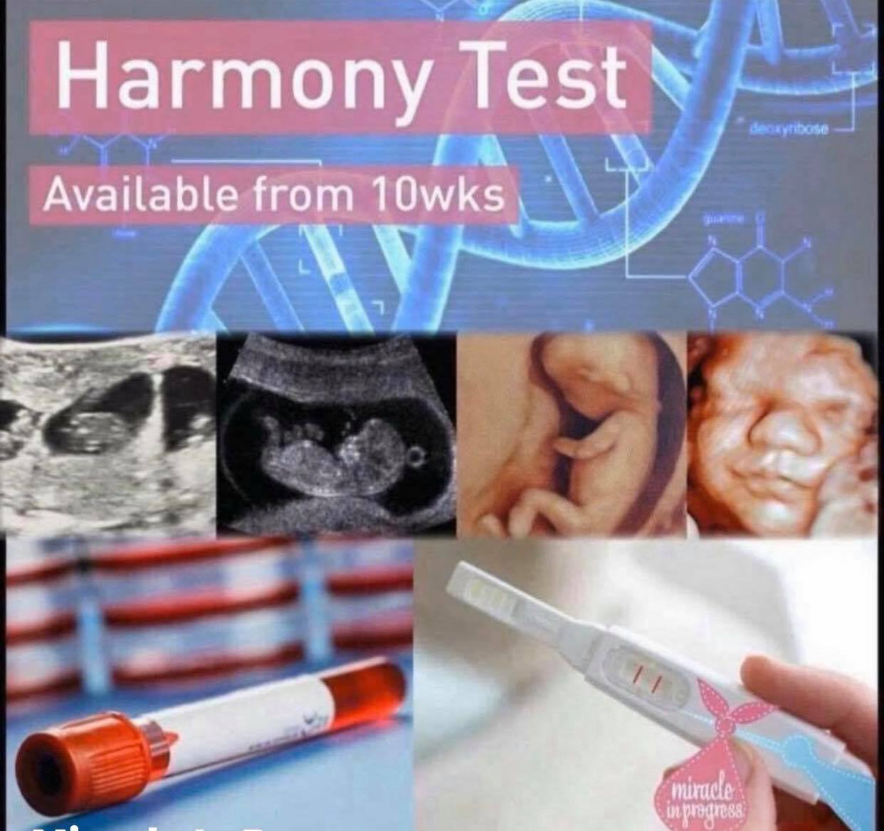 Harmony Test Kent : Non-Invasive Prenatal Testing – AUYEMK