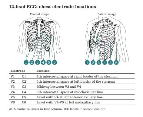 Cardiac Lead Placement Diagram Ecg Placement: Over 24 Royalty Free