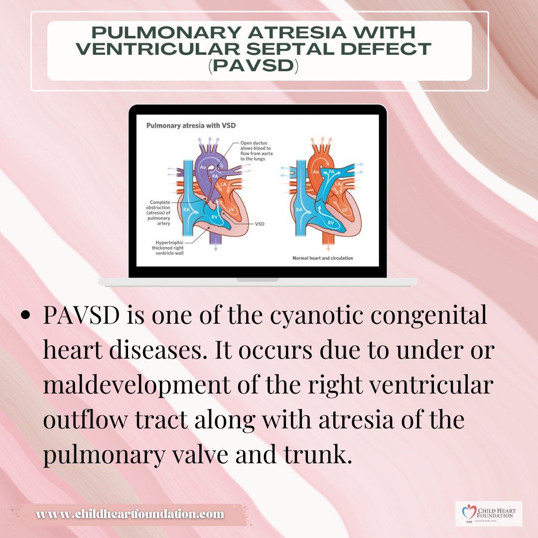 NEW TOPIC ALERT 🚨 Pulmonary... - Child Heart Foundation