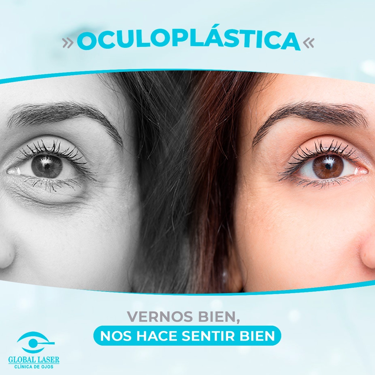 Clínica de Ojos Global Laser - La 𝒄𝒊𝒓𝒖𝒈𝒊́𝒂 𝒑𝒍𝒂́𝒔𝒕𝒊𝒄𝒂 𝒐𝒄𝒖𝒍𝒂𝒓 o 𝒍𝒂 ...