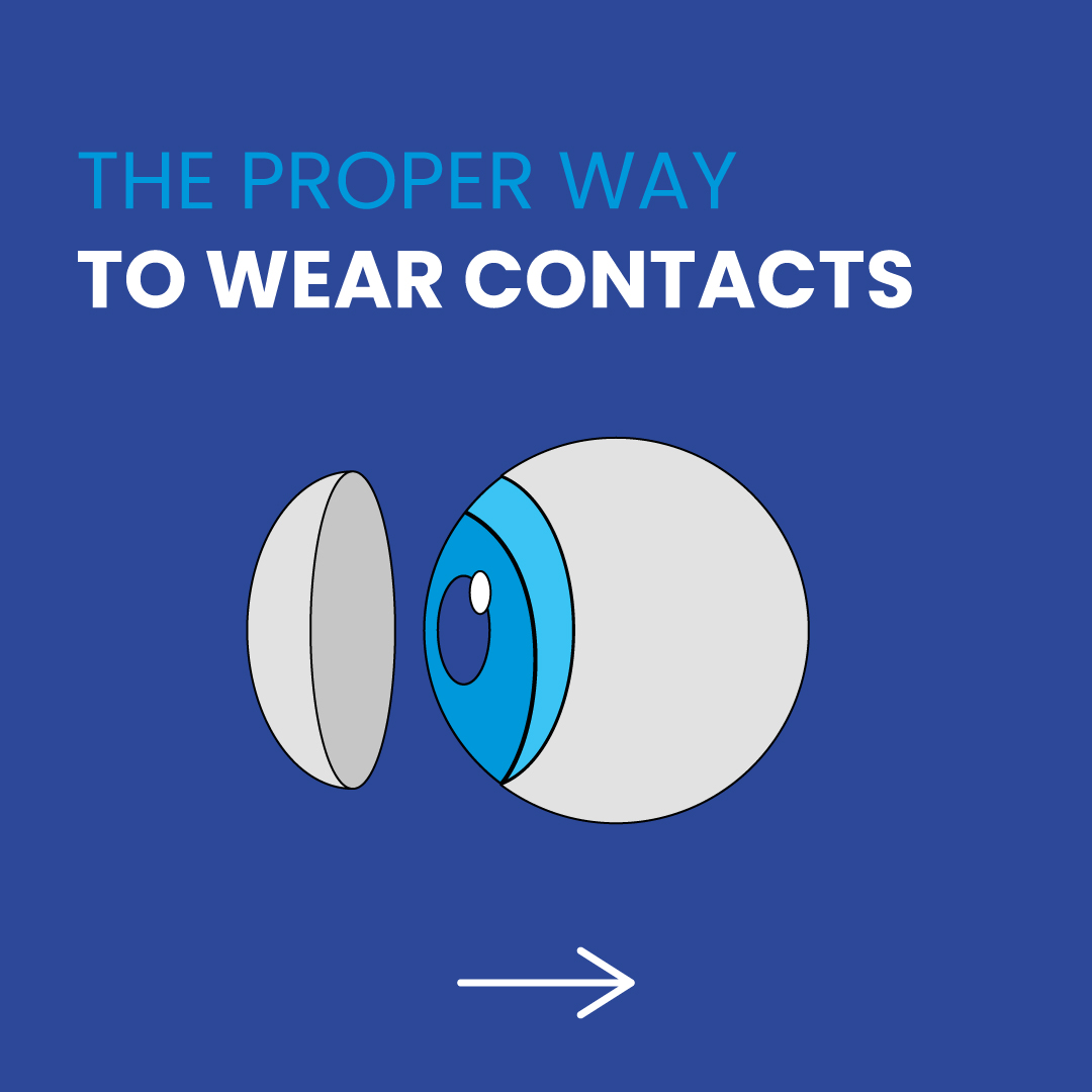 HOW TO PROPERLY WEAR CONTACT LENSES 👉🏽... - Synergy Optometry
