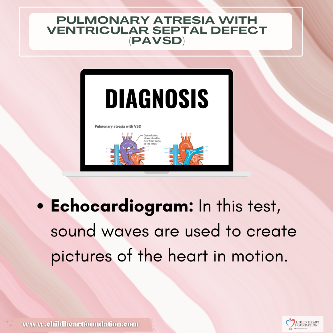 DIAGNOSIS OF PAVSD🚨... - Child Heart Foundation