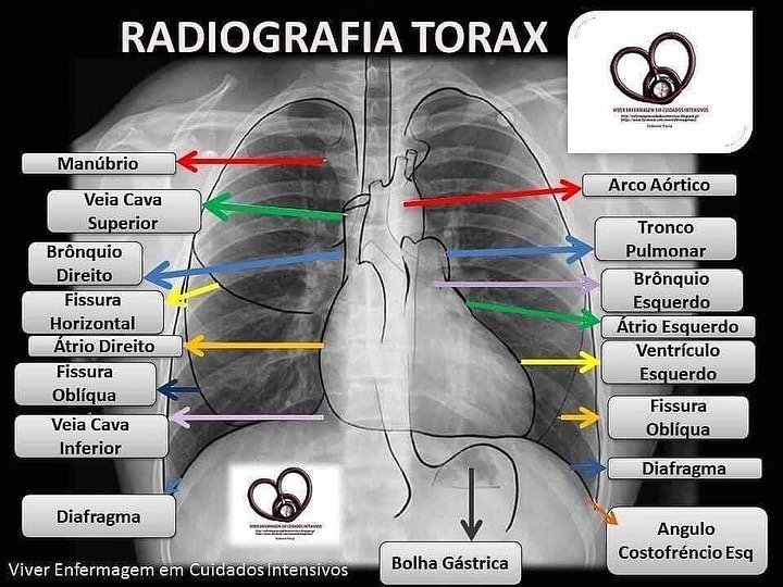RX normal. comprendamos un poco mas los... - David Bedoya M.D | Facebook