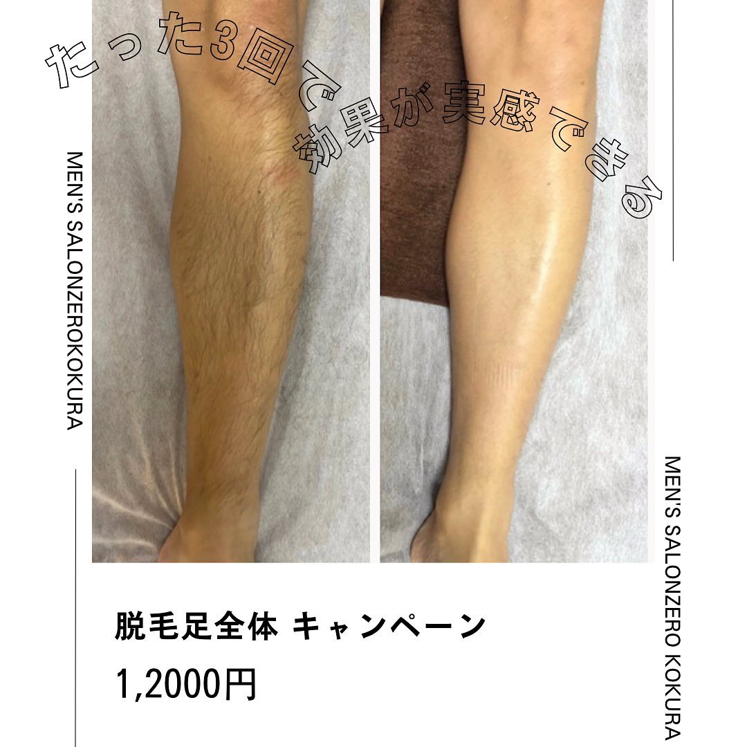 小倉 メンズ エステ