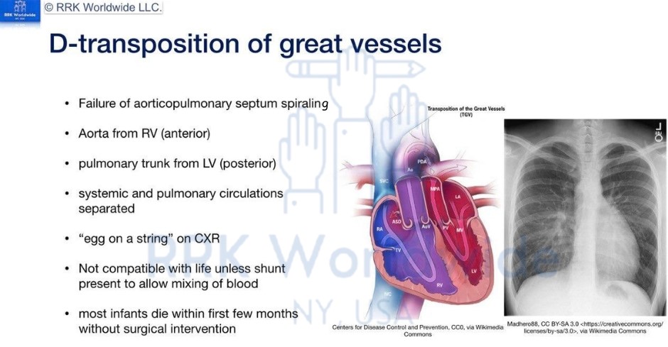 RRK - Master the Complex: Transposition of Great Arteries 🫁📘 Elevate ...