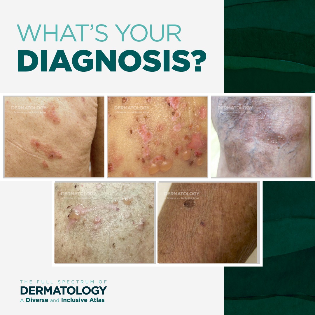 The Full - Decoding Dermatology: What’s Your Diagnosis? Each week we ...