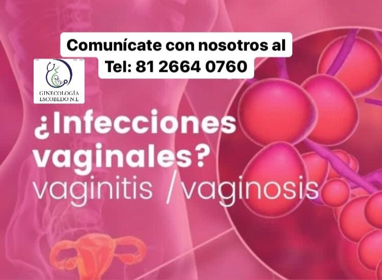 Ginecologia Escobedo N.L Tel: 8183846783 | General Escobedo
