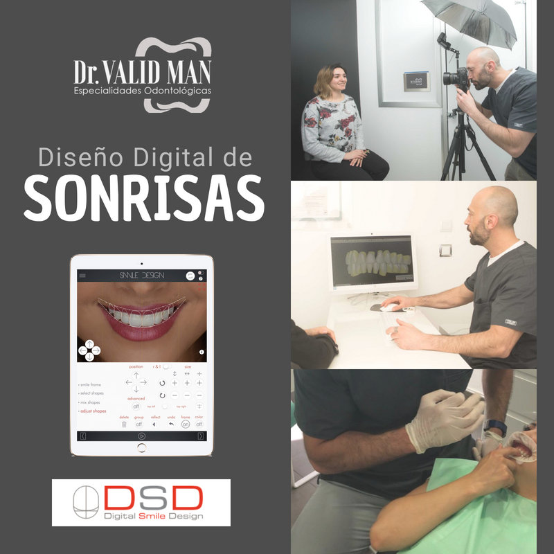 Dr Valid Man - El novedoso “Digital Smile Design” nos...
