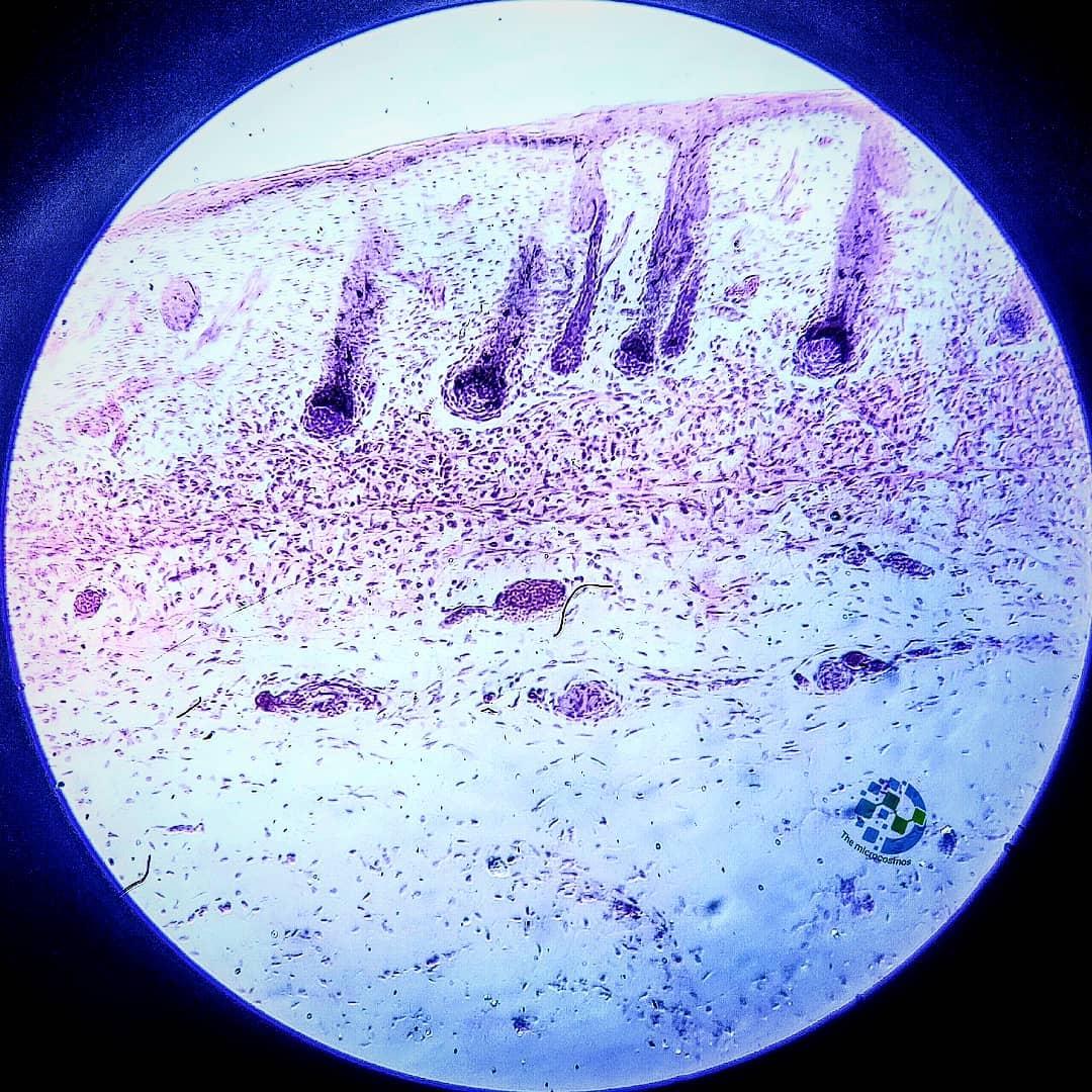 The microcosmos - The mammalian skin is divided into two distinct ...