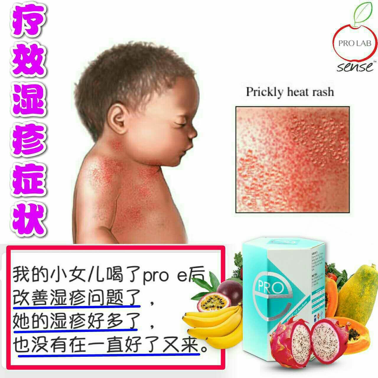 Share good - 我的小女儿皮肤差😔 时不时湿疹好了又来😢 只从摄取了 #PROe 疗效女儿湿疹症状👊...