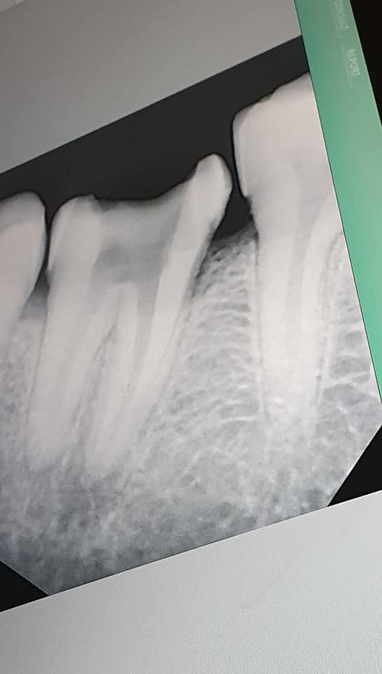 Dr. Rihal's Dental Clinic | Goraya
