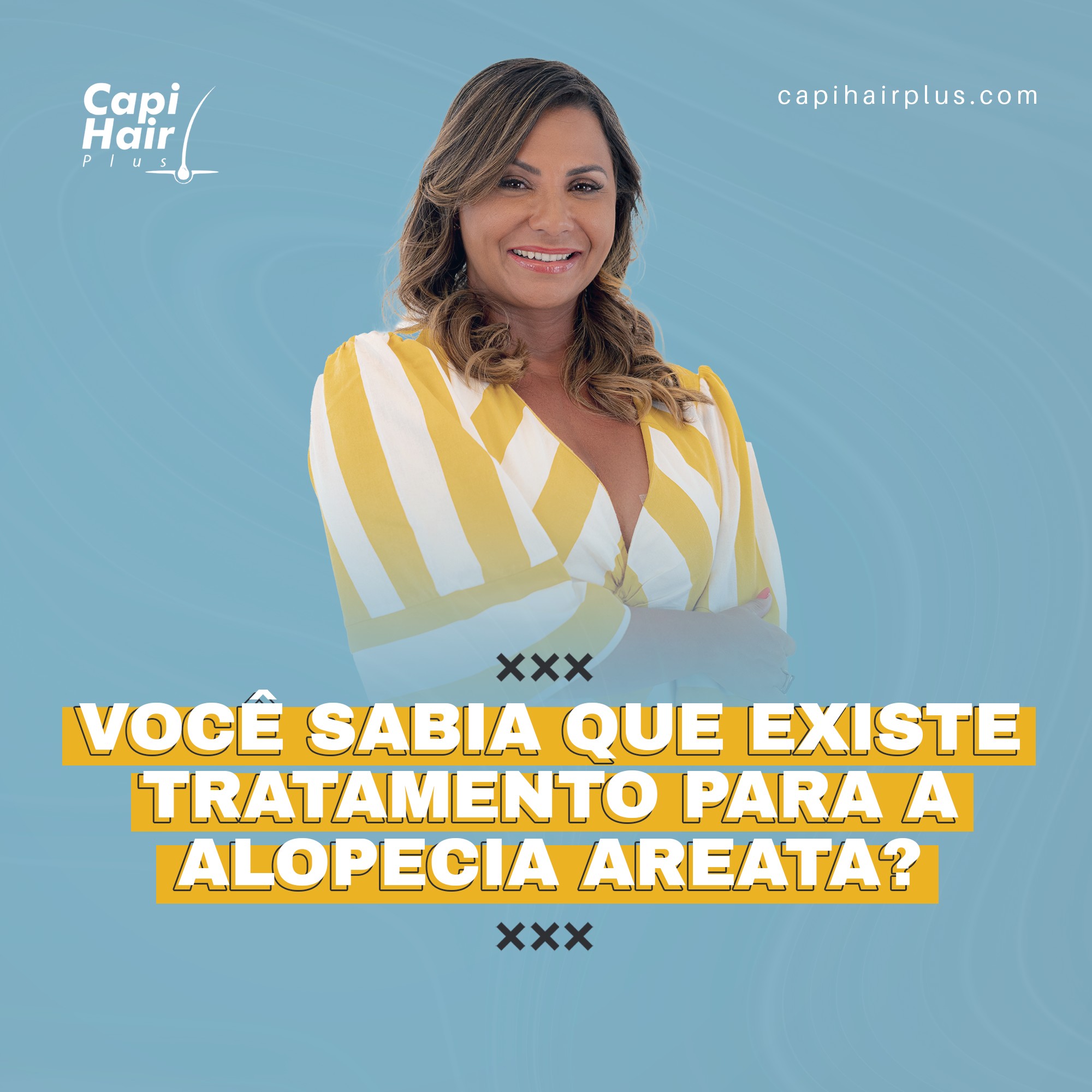 Capi Hair Plus - Como tratar a alopecia areata A alopecia areata não ...