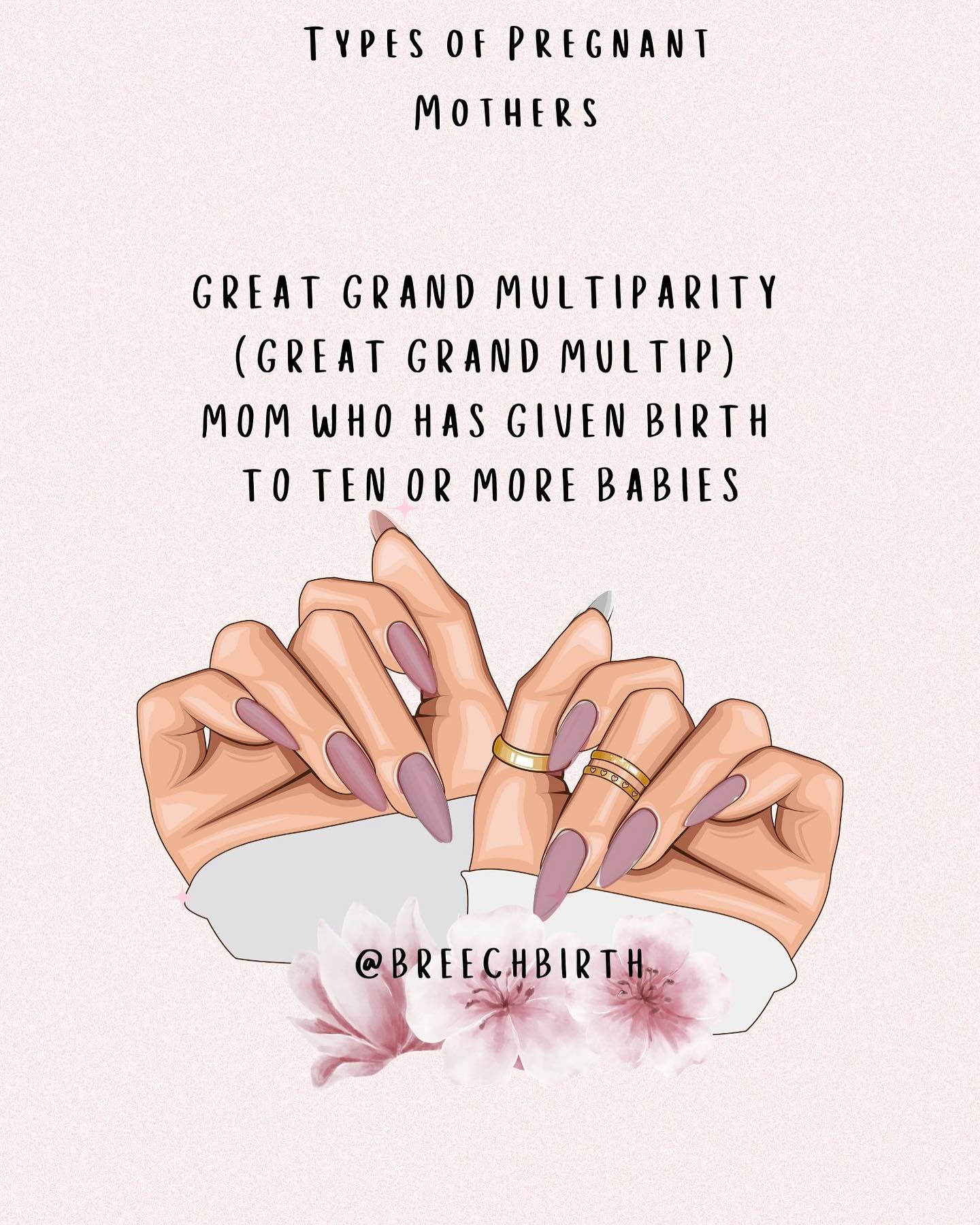 Breech Birth - TYPES OF PREGNANT MOTHERS Terms are in...