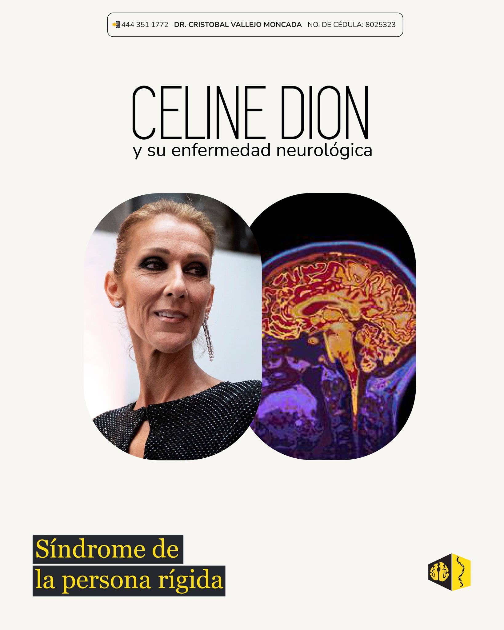 El Síndrome de persona rígida es una enfermedad neurológica que se ...