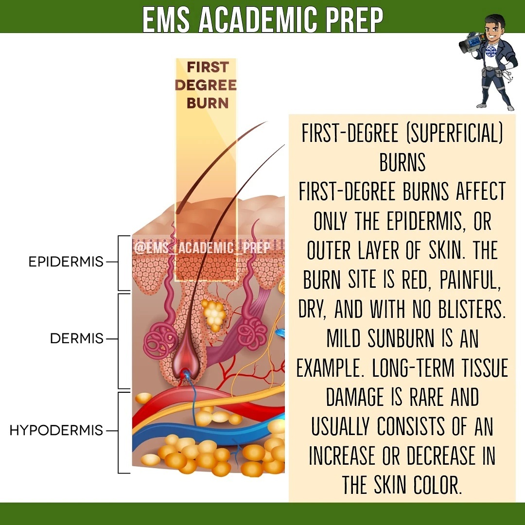 EMS Explained - Burns that affect only the superficial... | Facebook