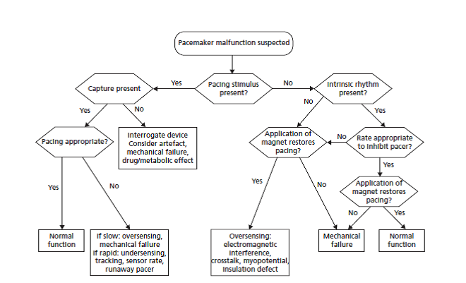 CardioVasc - A guide for evaluating suspected pacemaker...