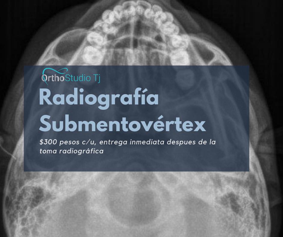 Ortho Studio Tj - RADIOGRAFÍA SUBMENTOVERTEX Permite el estudio de la ...
