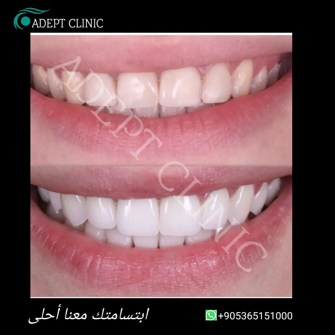 Adept clinic health care in turkey | Istanbul