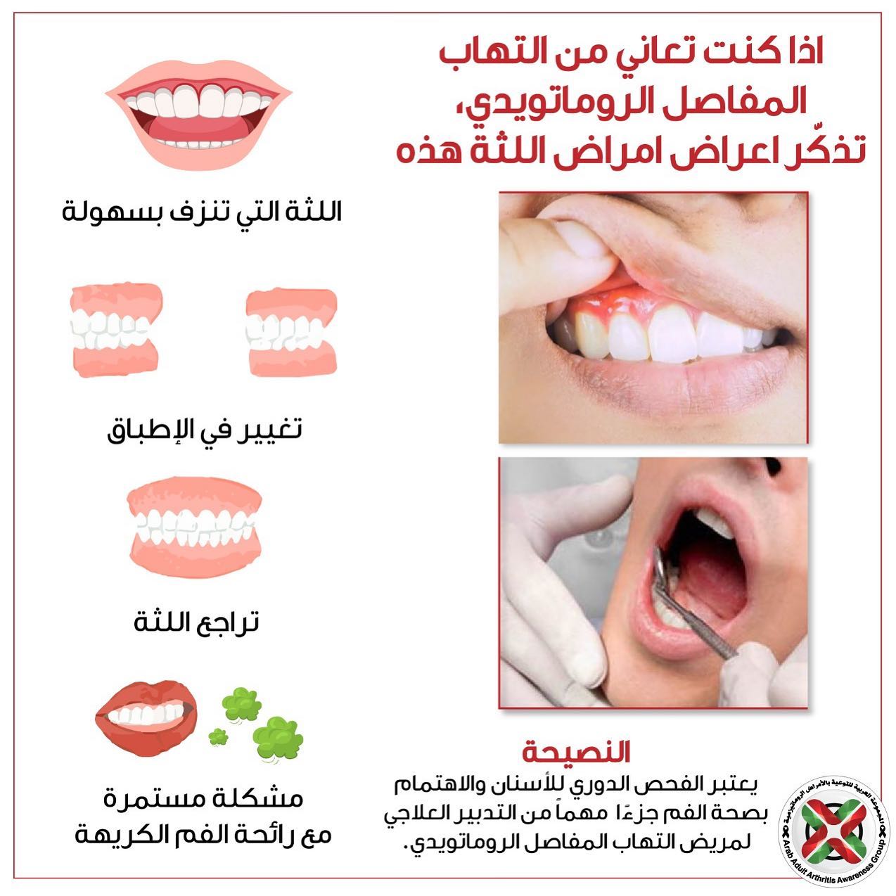 عيادة الدكتور عمرو محمد حواش لأمراض الباطنة والروماتيزم والمناعة Posts Facebook