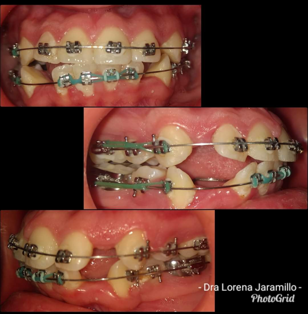 Dra. Lorena Jaramillo added a new... - Dra. Lorena Jaramillo
