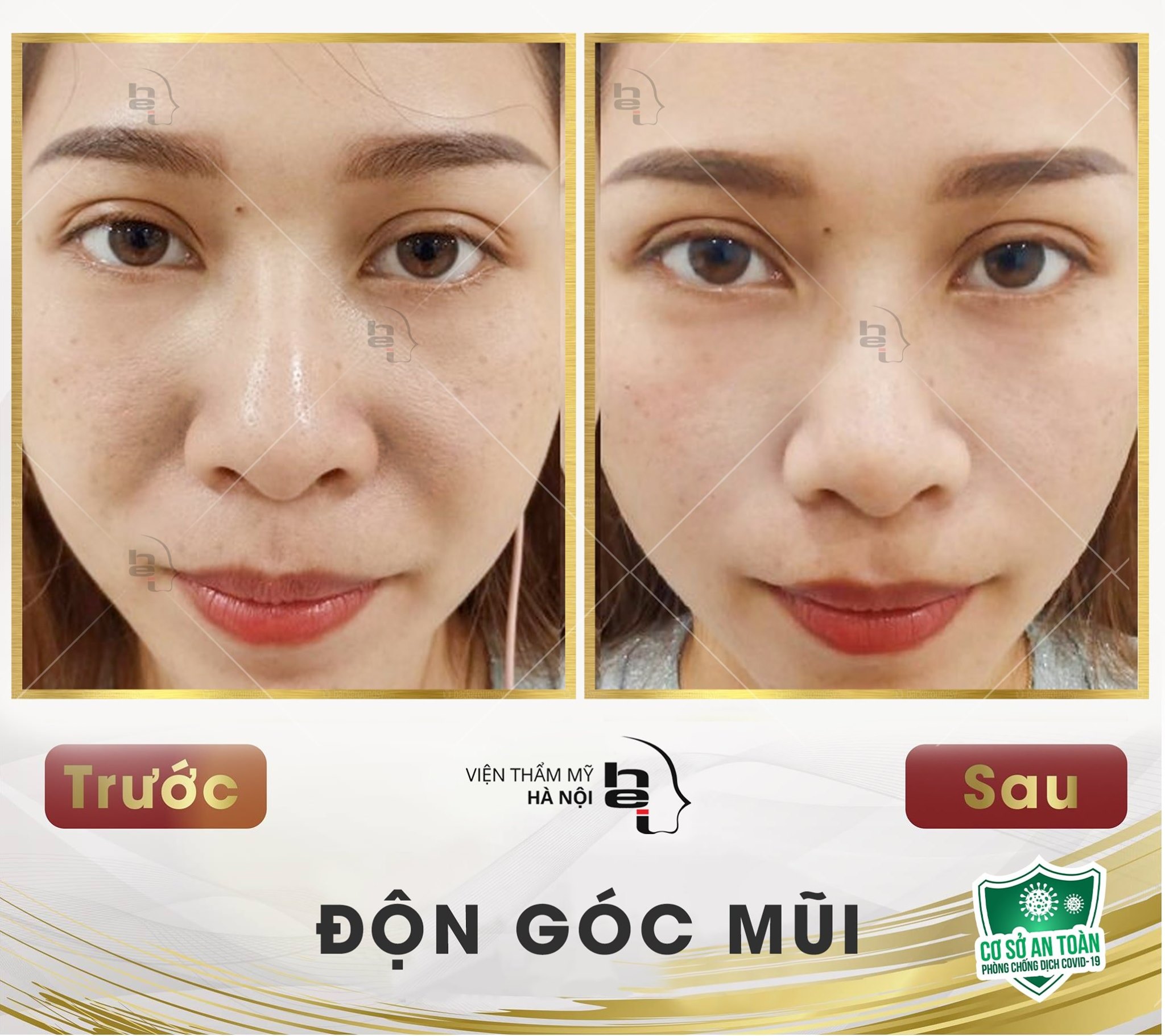 XÓA BỎ 