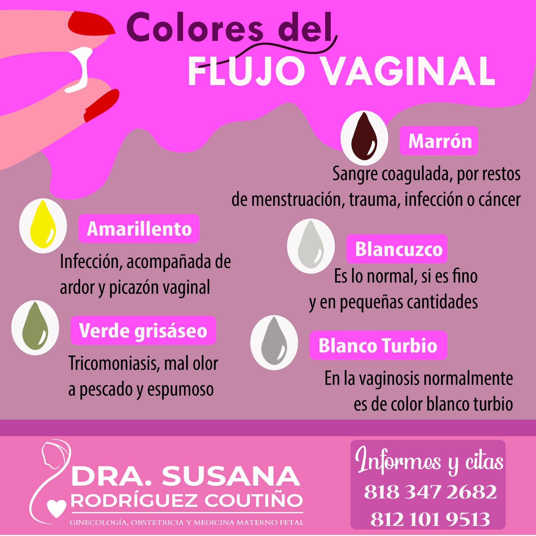 qu-es-exactamente-la-secreci-n-vaginal-en-pocas-palabras-es-un