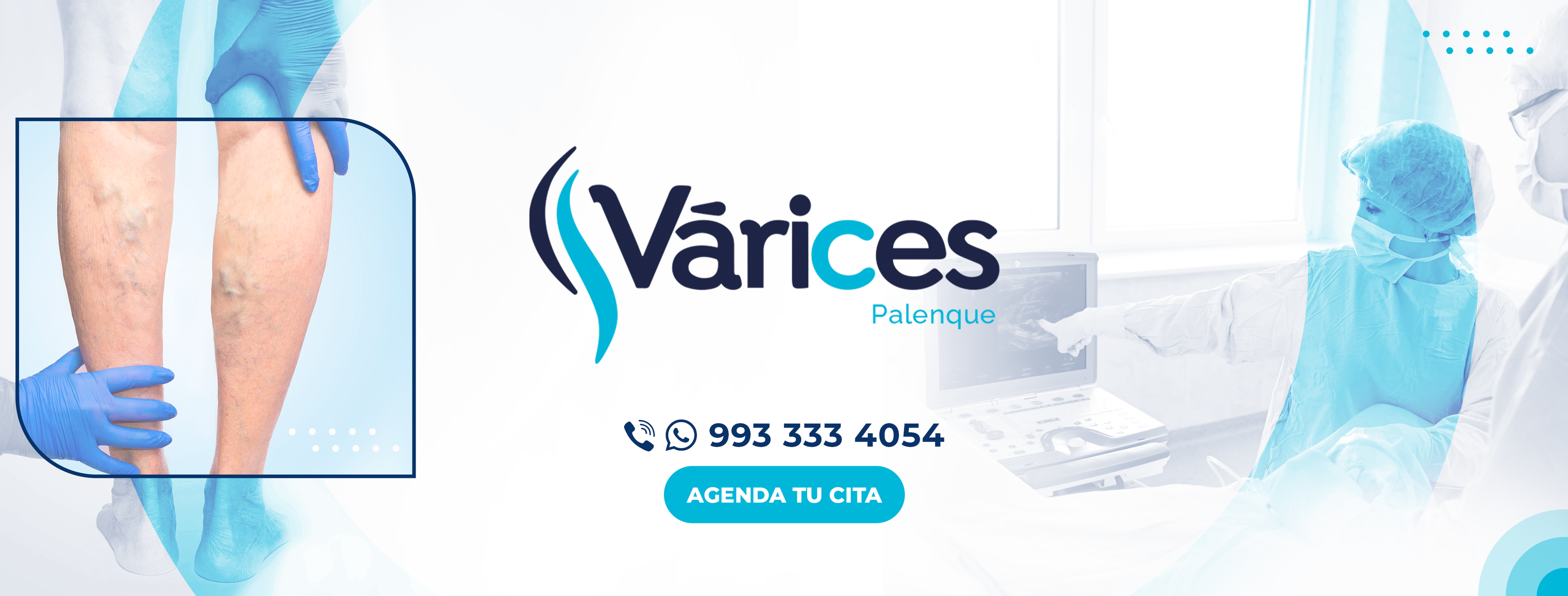 Várices Palenque | Palenque