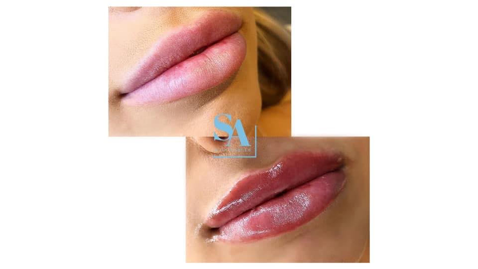 Seton’s Cosmetics Clinic... - Seton’s Cosmetics Clinic