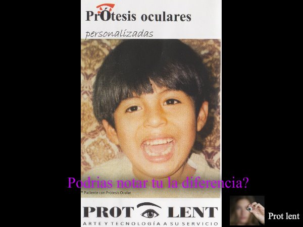 Prot-Lent - Protesis Oculares | Lima