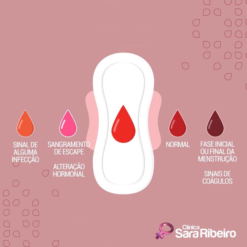 Dr. Christiano Ribeiro - O que a cor da sua menstruação quer dizer ...