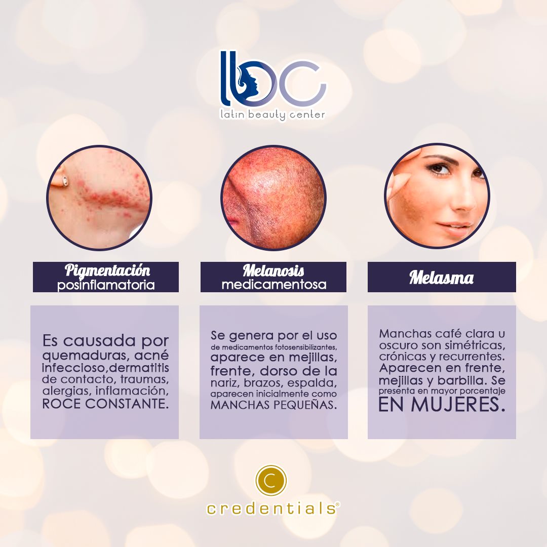 ¿Sabías que existen diferentes tipos de pigmentación? 🤔 👉 Cada uno de