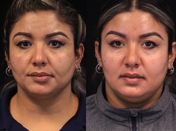Skin Spectrum - This amazing patient took the topical leap... | Facebook