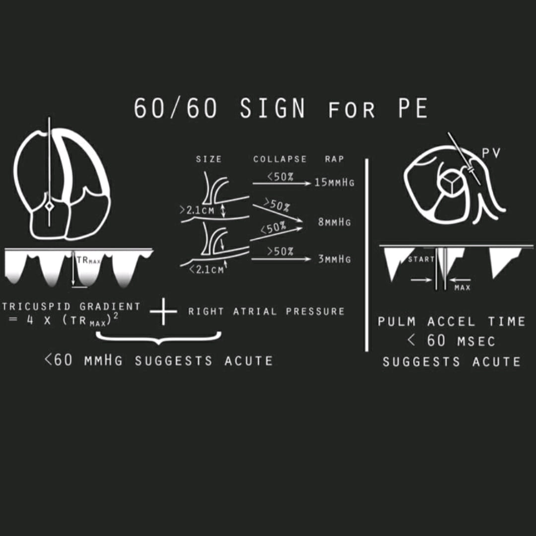 Cardiopedia - Follow us on instagram...