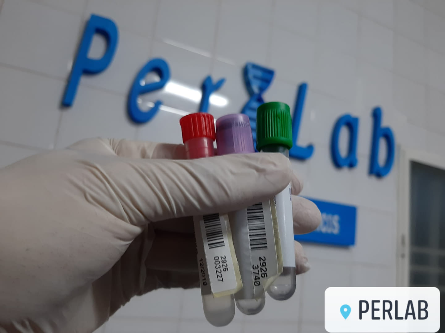 PerLab - La prueba de hemoglobina glicosilada (HbA1c) es...