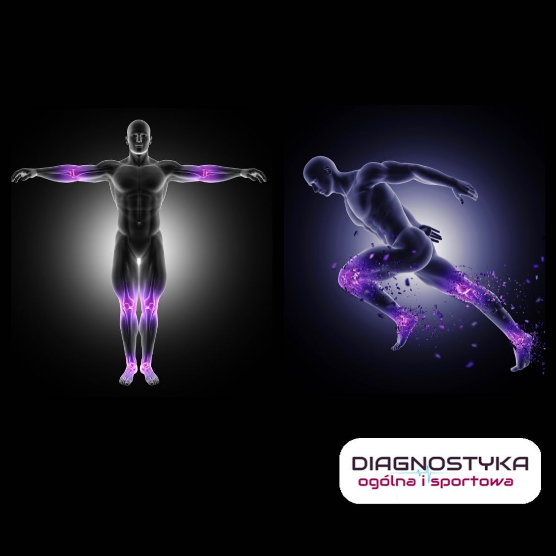 diagnostyka-og-lna-i-sportowa-warsaw
