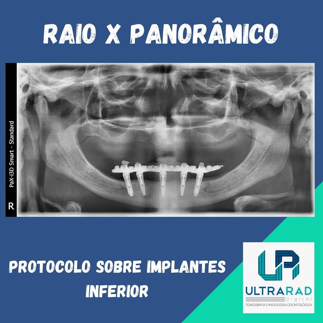 O exame... - Ultrarad - Radiologia Odontológica Digital