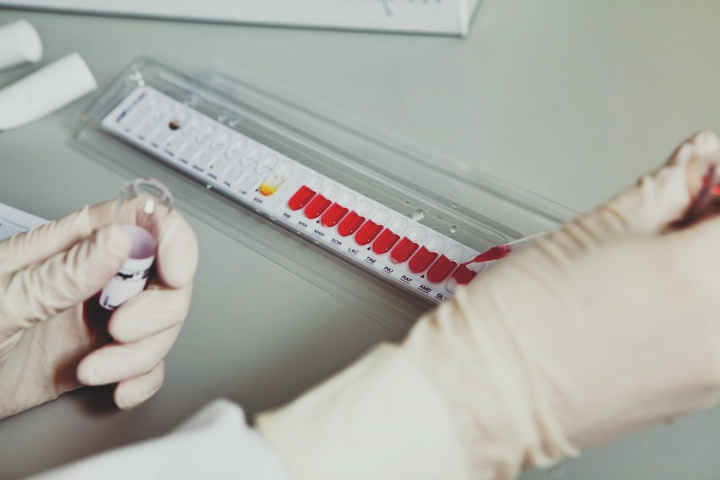 What is HLA Tissue Typing?... - Medvin Clinical Research