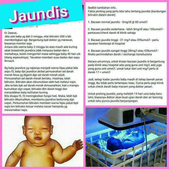 Firmax3 Magic Cream Sarawak Firmax3 Dan Baby Jaundis Kuning Q A Dr Zz Masalah Baby Kuning Jaundis Salam Doc Kalau Baby Baru Lahir Seminggu Dan Ada Penyakit Kuning Nak Sapu Kat
