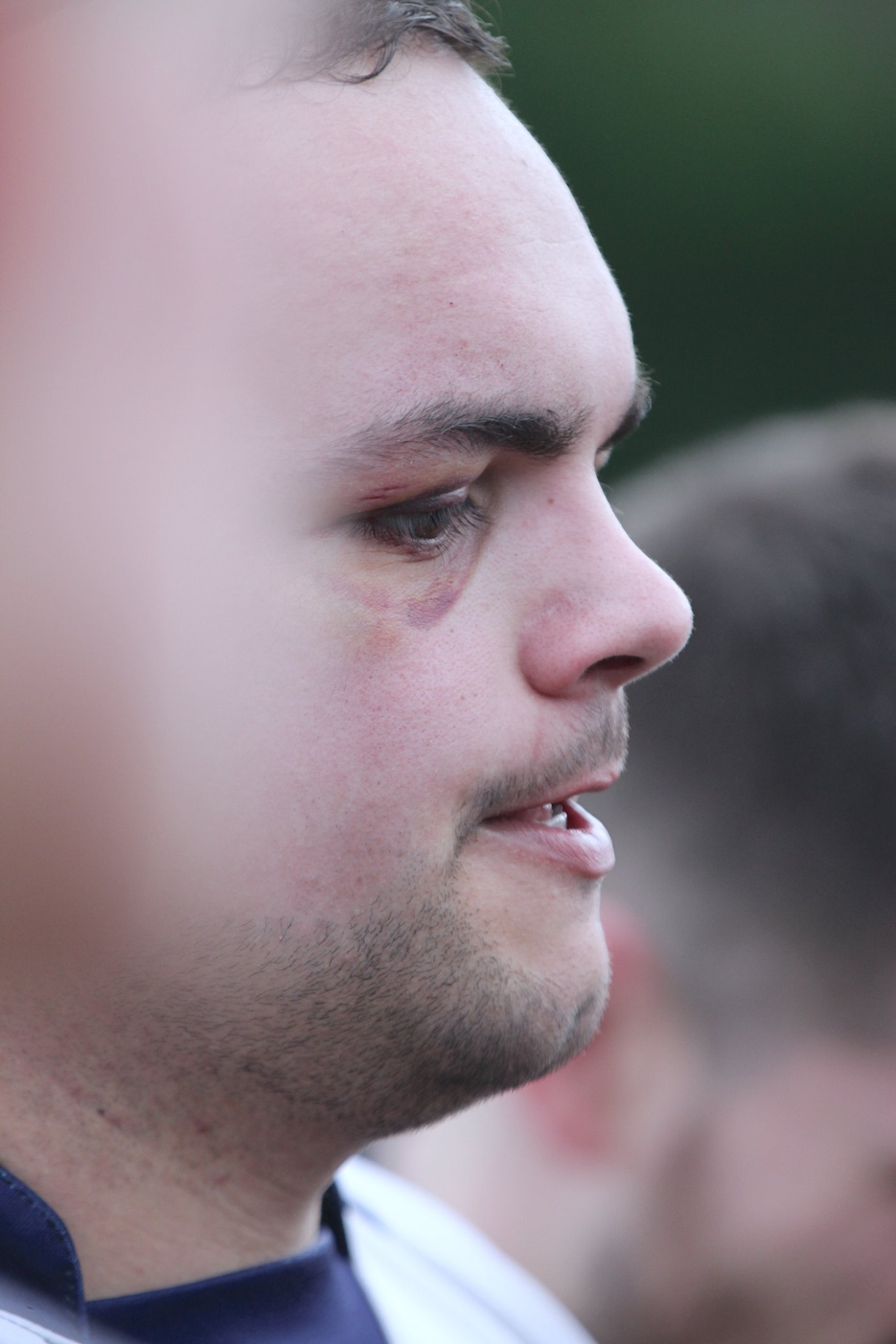 Metropolitan Police Rugby Football Club (MPRFC) | Esher