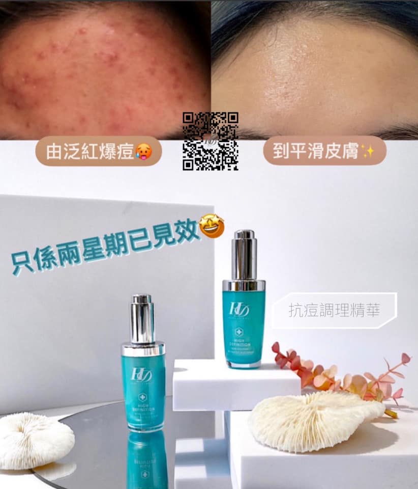 FLY UP HD Macau - 痘痘冒出前的抵禦法寶🔰只要感覺到開始紅腫痛+微隆起⚠️就是冒痘預警🚨這時靠史上最溫... | Facebook