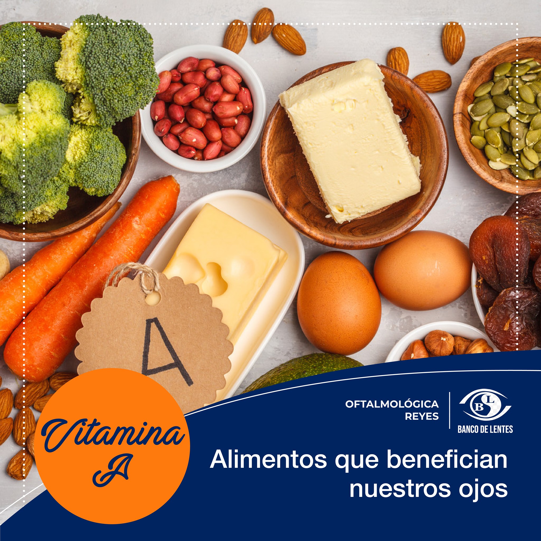 OftalmoReyes - Los alimentos ricos en vitamina A, te...