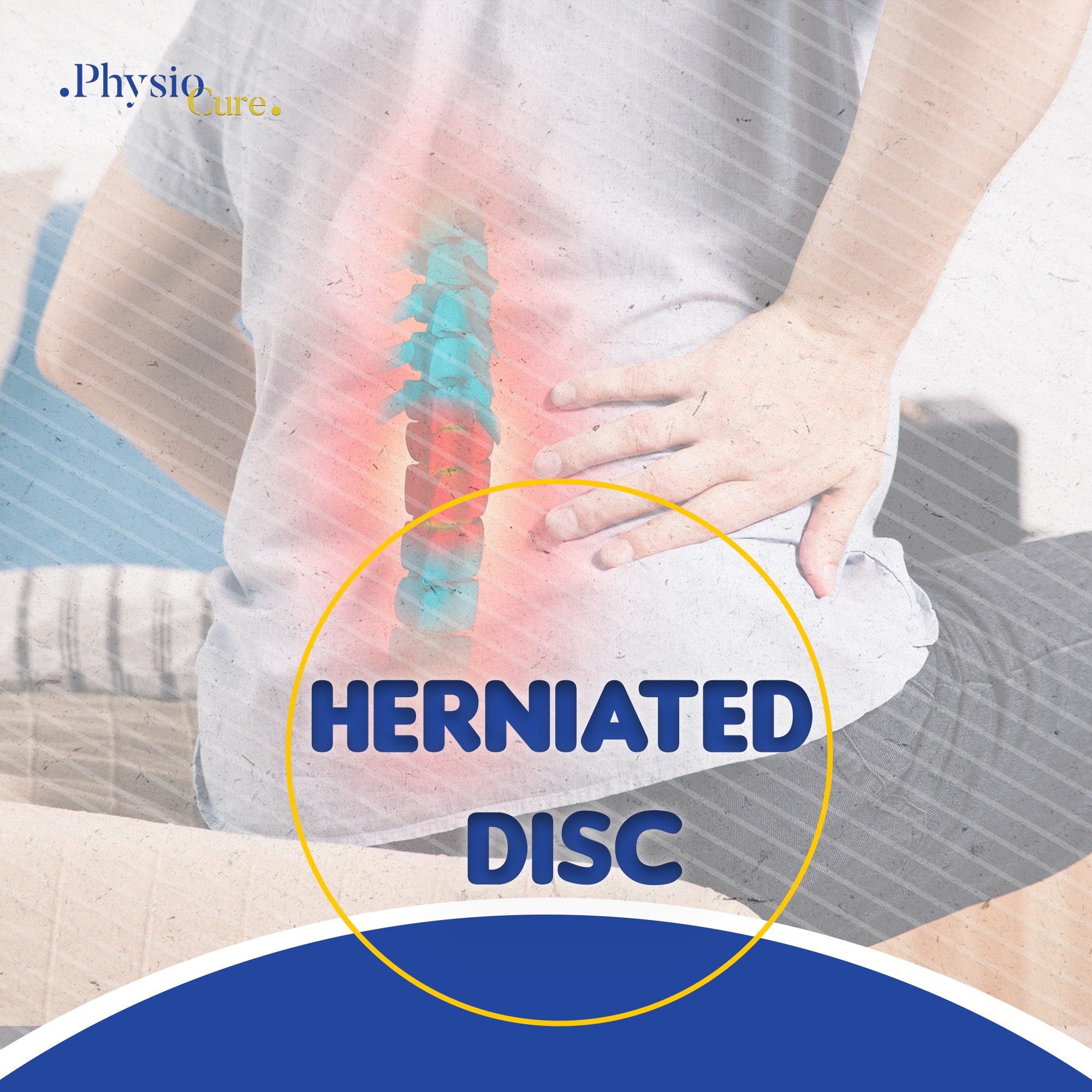 Physio Cure - What are the types of herniated disc Lumbar herniated ...