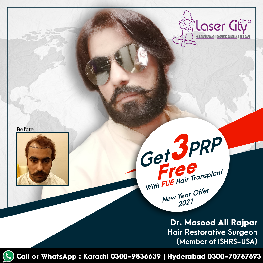 New Year 2021 Offer Get 3 PRP Free with FUE Hair Transplant for limited ...