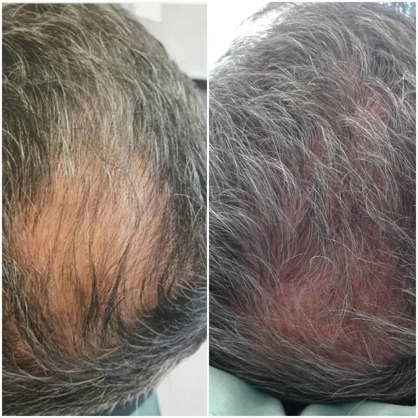 Stratford Plastic Surgery - REAL RESULTS FROM THE CLINIC👉🏼 Before ...