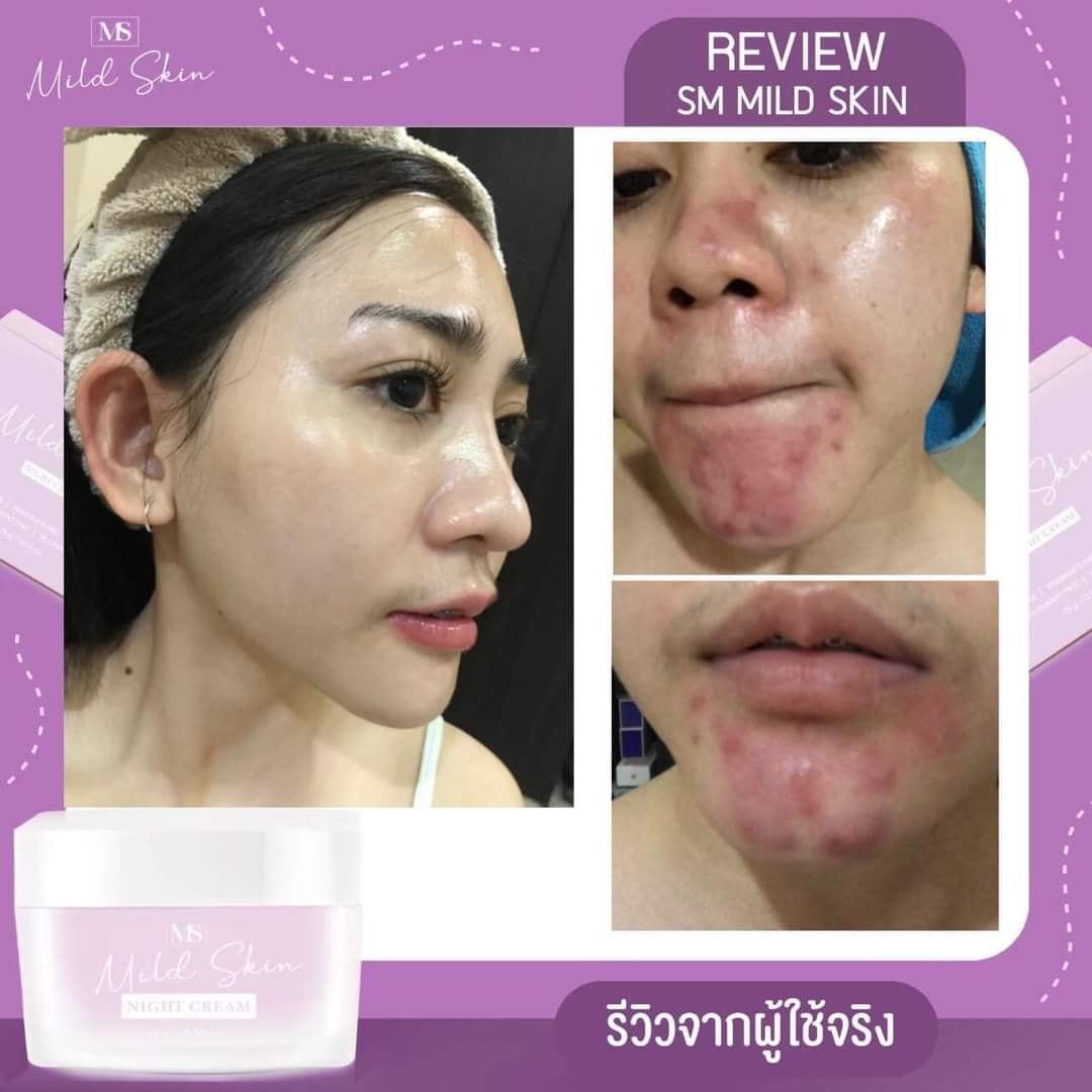 มีใครให้ใสกว่านี้ไหม 💜 #ms... - ครีมms mild skin | Facebook