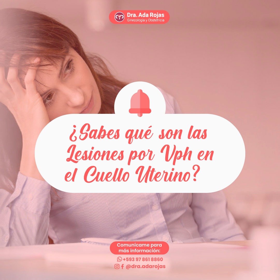 Dra. Ada Rojas - .🧐 ¿Sabes que son las Lesiones por #VPH...