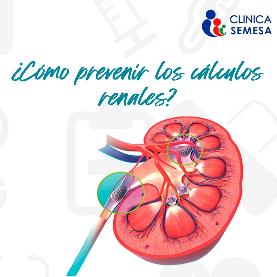 Clínica Semesa - La prevención se basa en medidas...