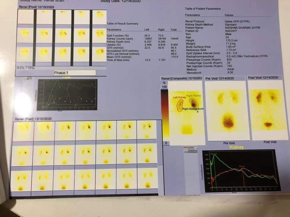 First DTPA Scan performed in the... - Chitwan Medical College | Facebook