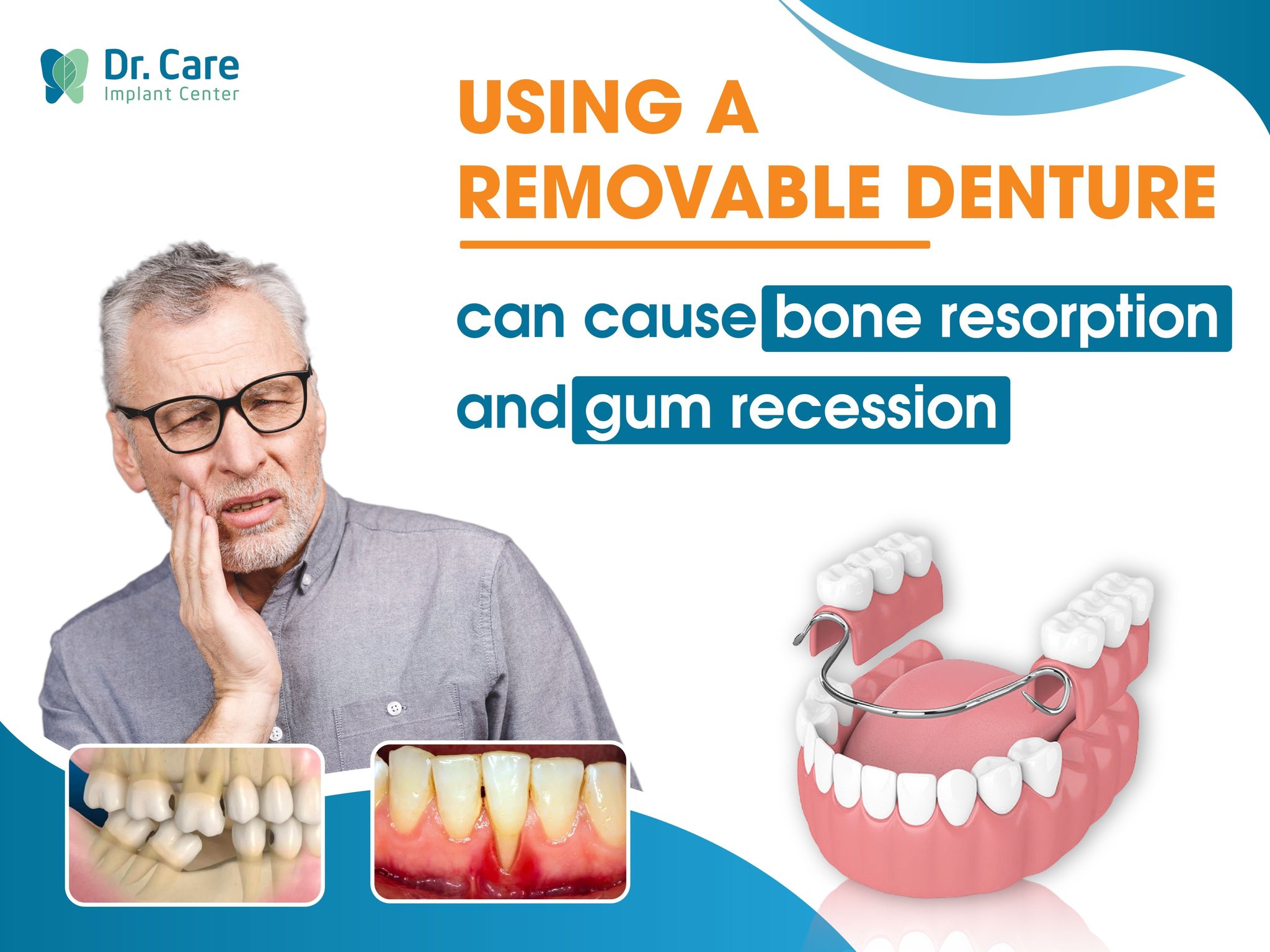 Dr. Care Implant Center - All on 4 Specialist in VietNam - ⚠️ USING A ...