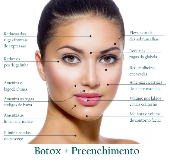 *BOTOX*... - Dr. Adilson Félix Pimenta - Cirurgião dentista Cro/sp: 115759